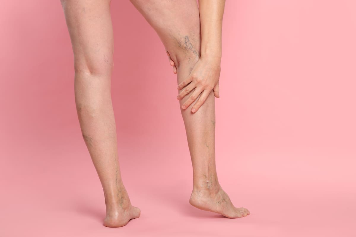 Какие болезни лечит флеболог и основные симптомы для обращения к специалисту